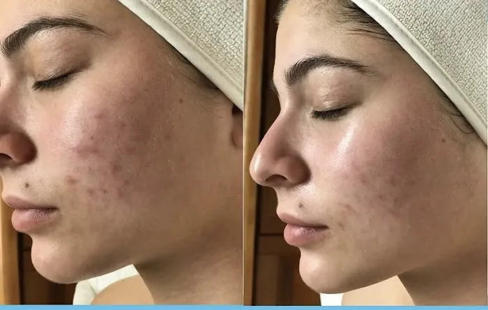 Lasting Impression Corrective Skincare Picture 5