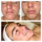 Lasting Impression Corrective Skincare