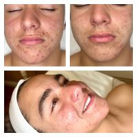 Lasting Impression Corrective Skincare ico