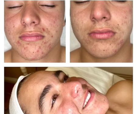 Lasting Impression Corrective Skincare