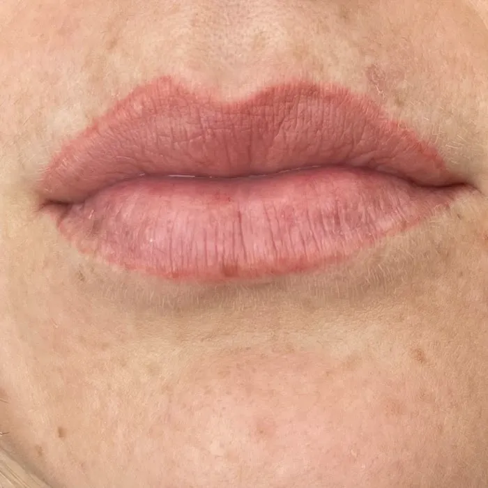 Affinity Cosmetic Center Picture 3