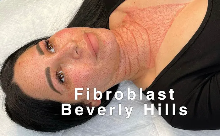 Fibroblast Beverly Hills Picture 3
