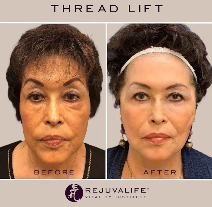 Rejuvalife Vitality Institute Picture 9