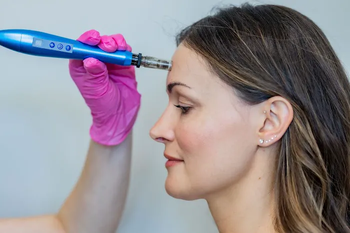 The Skin Whiz Picture 3