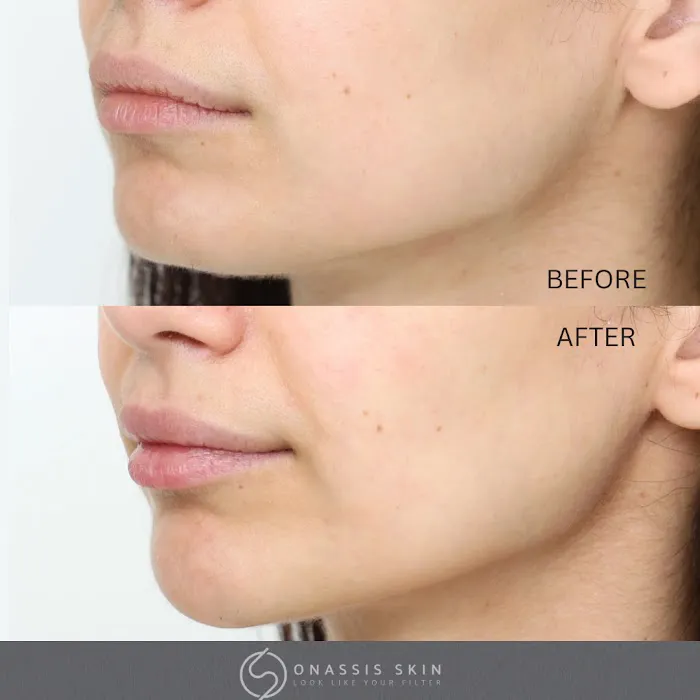 Onassis Skin Picture 3