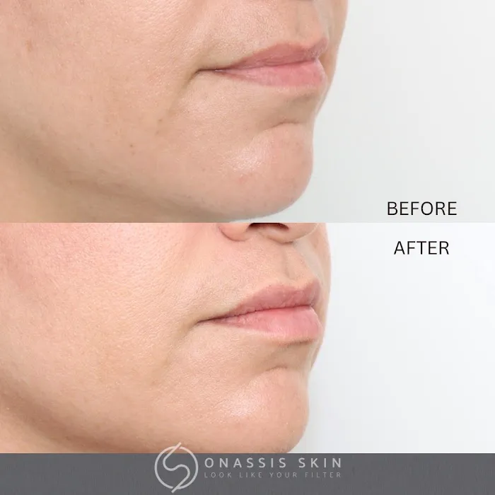 Onassis Skin Picture 1