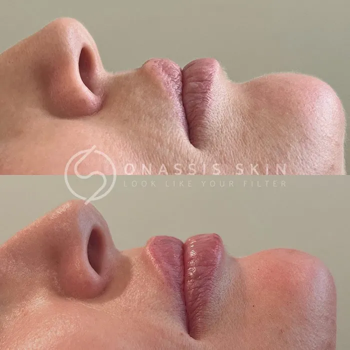 Onassis Skin Picture 6