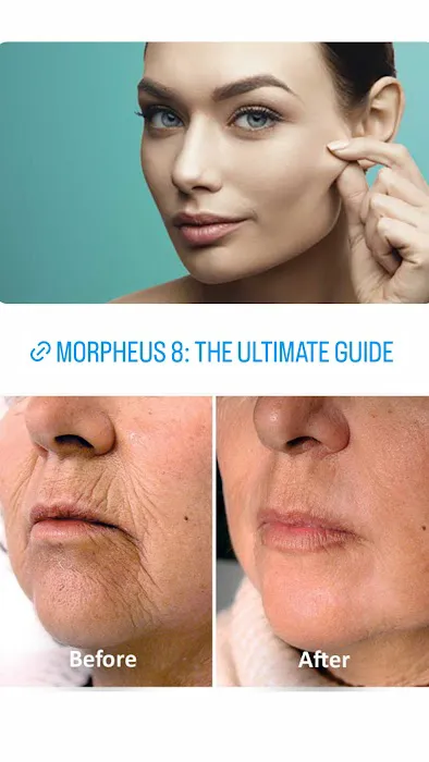 Onassis Skin Picture 4