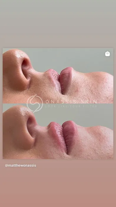 Onassis Skin Picture 5