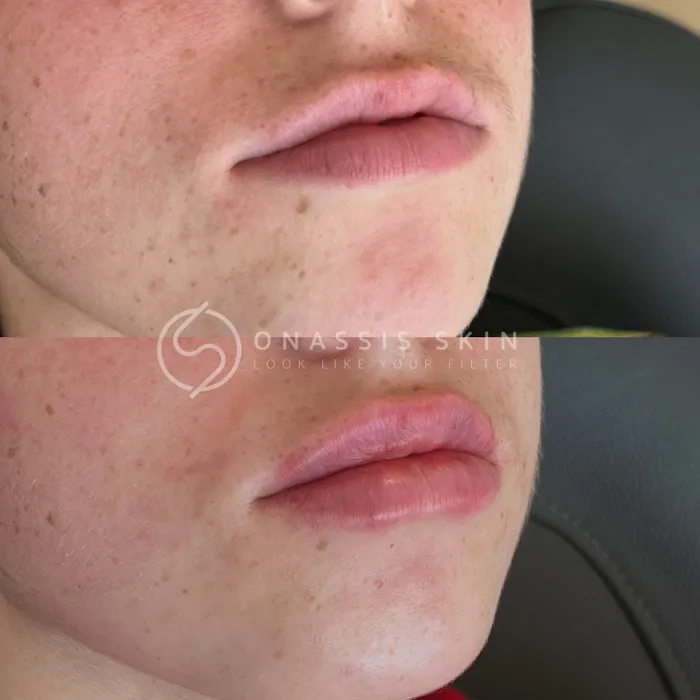 Onassis Skin Picture 9