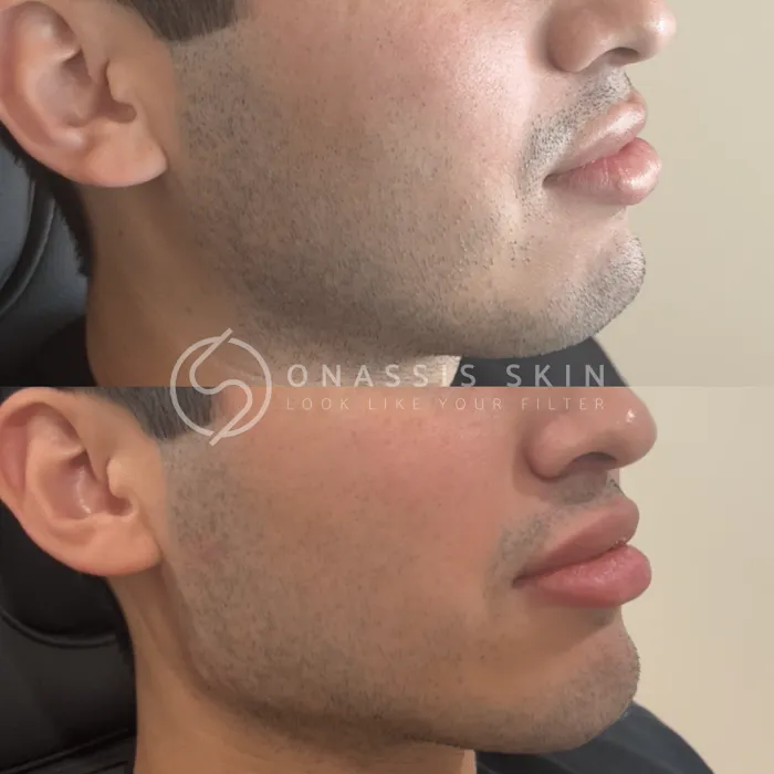 Onassis Skin Picture 10