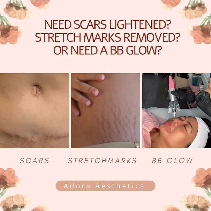 Adora Aesthetics Picture 8