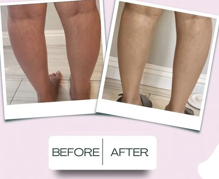 Adora Aesthetics Picture 2