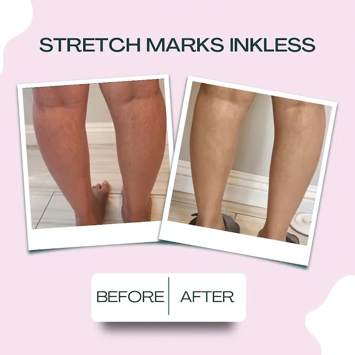 Adora Aesthetics Picture 7