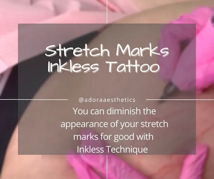 Adora Aesthetics Picture 3