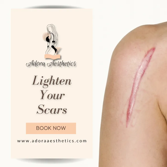 Adora Aesthetics Picture 10