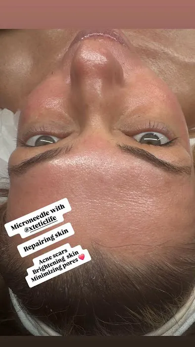 La Luna Aesthetics Picture 4