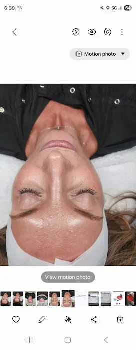 La Luna Aesthetics Picture 1