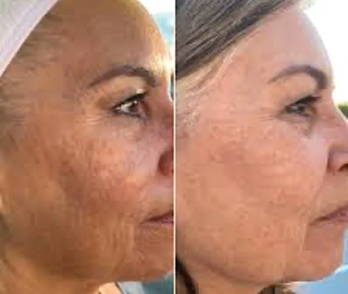 OC Fresh Look Picture 5