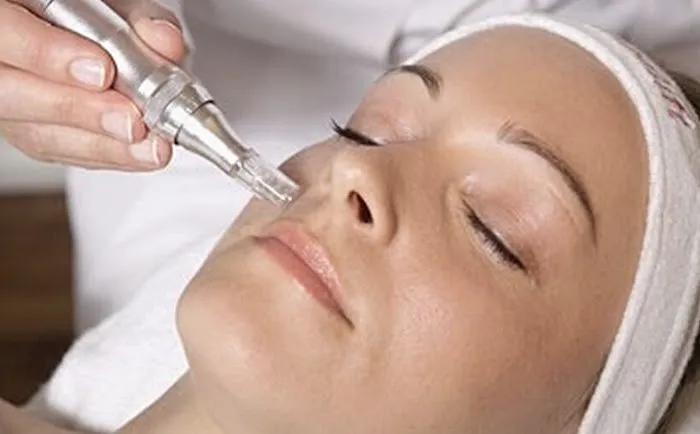 OC Fresh Look Picture 8