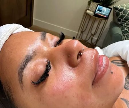 Pure Skin Esthetics Skin Clinic