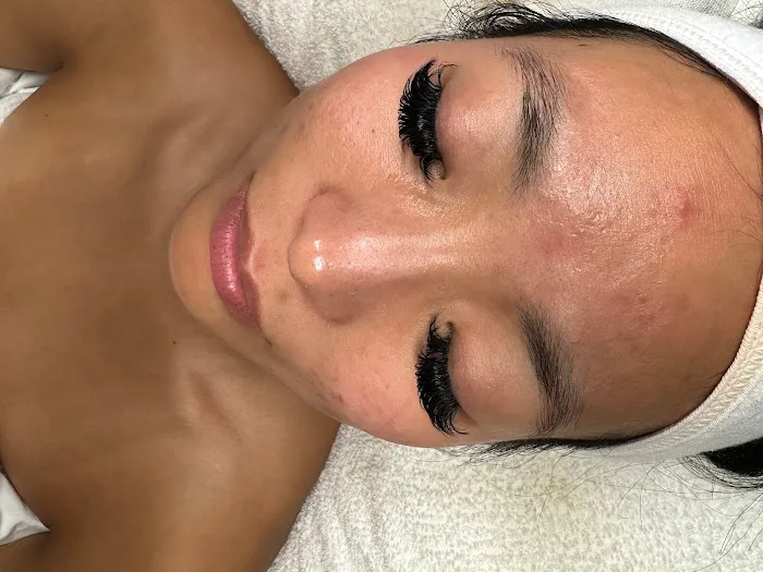 Pure Skin Esthetics Skin Clinic Picture 5