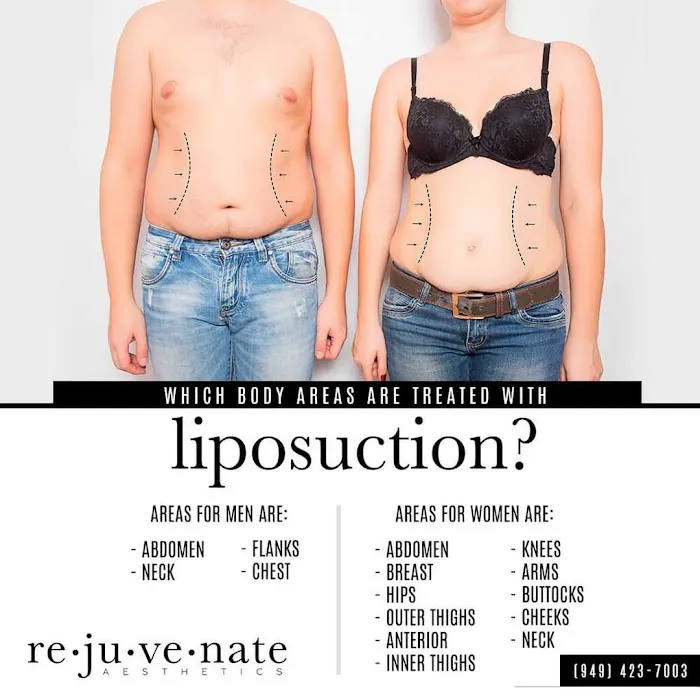 Rejuvenate Aesthetics Picture 3