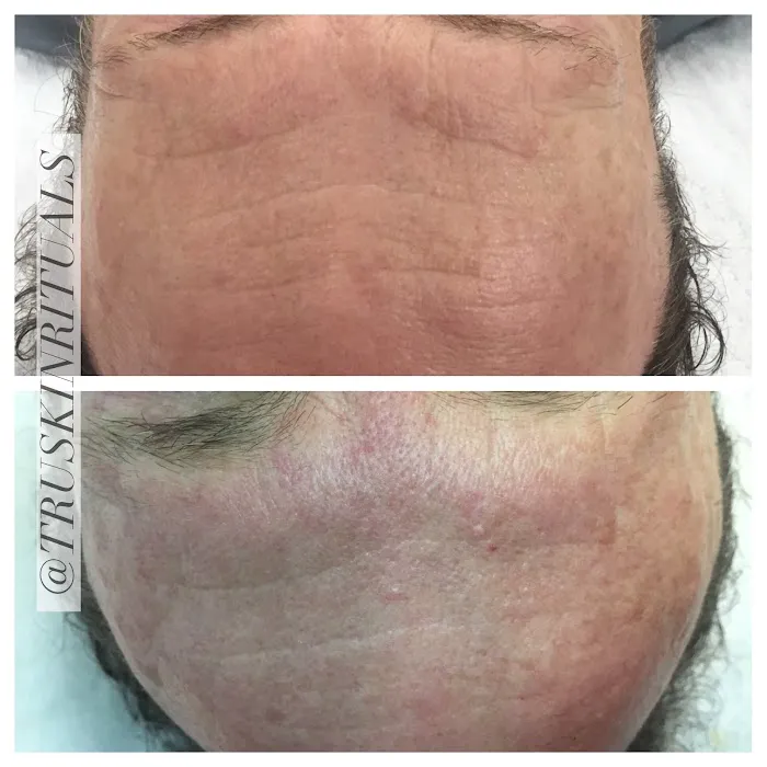 Tru Skin Rituals Picture 9
