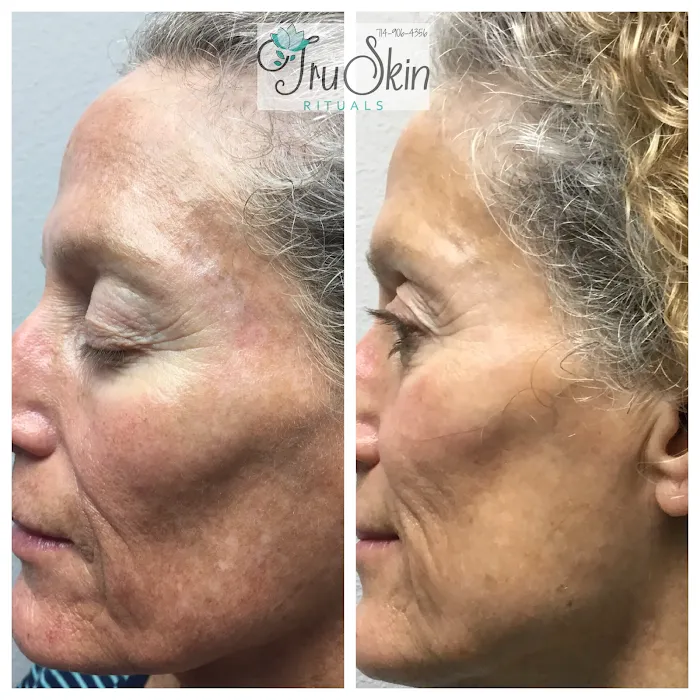 Tru Skin Rituals Picture 10