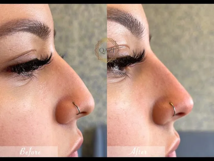 Qazi Cosmetic Center Picture 6