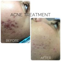 Esthetic company ico