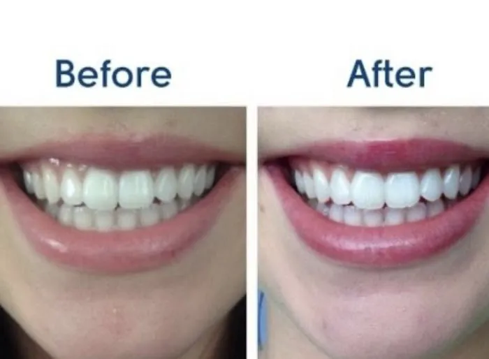 Vince Jacob Advanced Skincare Picture 9