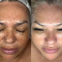 Kennedy Skincare ico