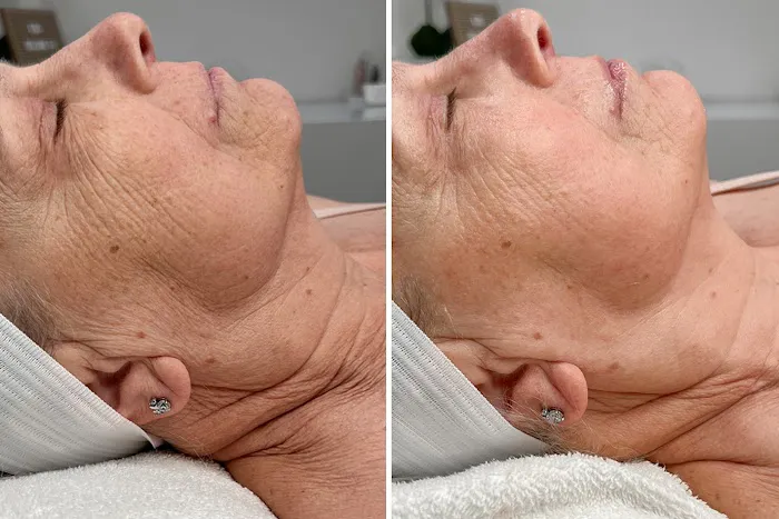 Five Point Five Skincare Picture 4