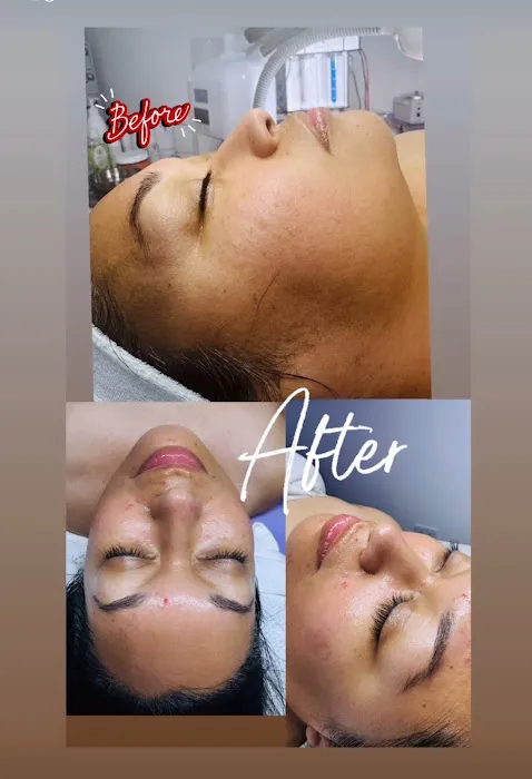 ZK Esthetician Picture 9