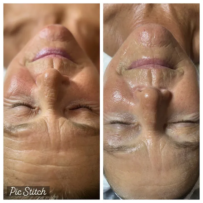 Skin by Holly Picture 6