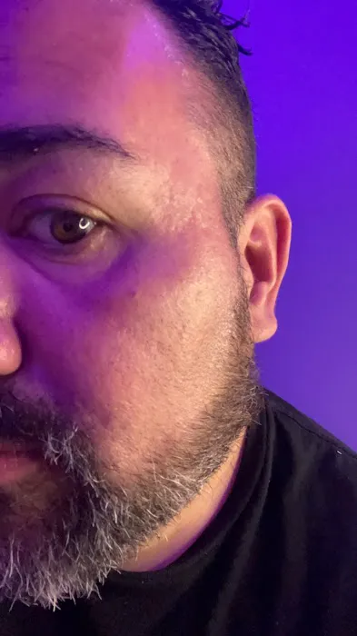 Skin Therapy Picture 2