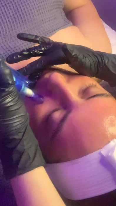 Skin Therapy Picture 7