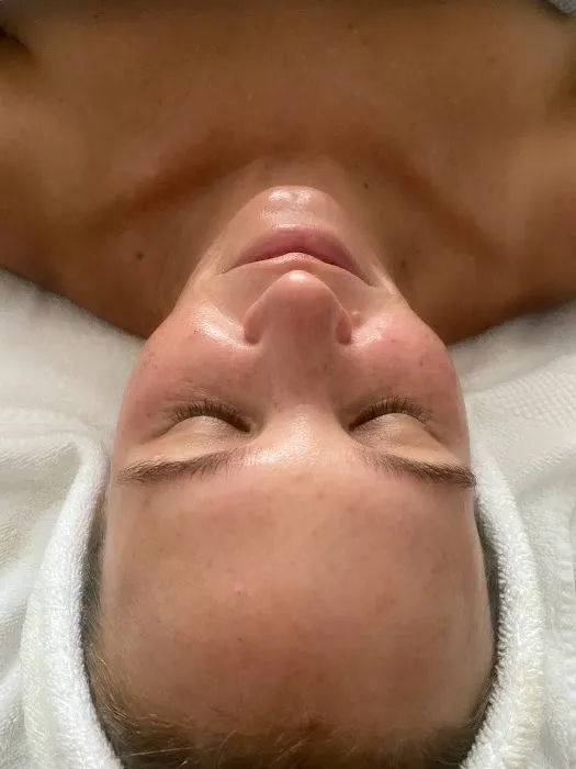 Nikol Iira Skin Care Picture 4