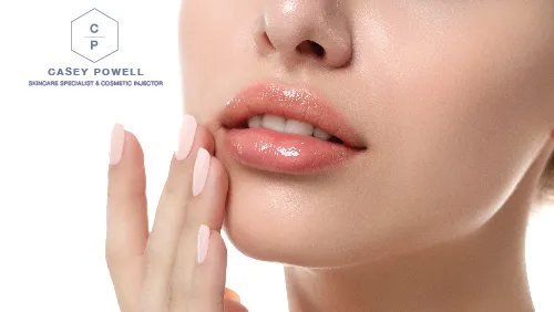 Casey Powell PA Aesthetic Injector & Skincare Specialist Picture 3