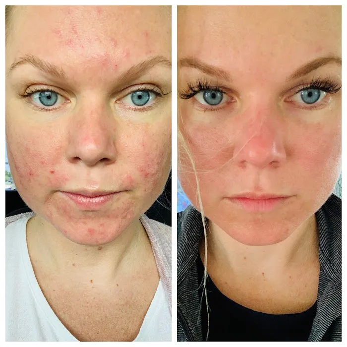 Vanessa Hernandez Skincare Picture 8