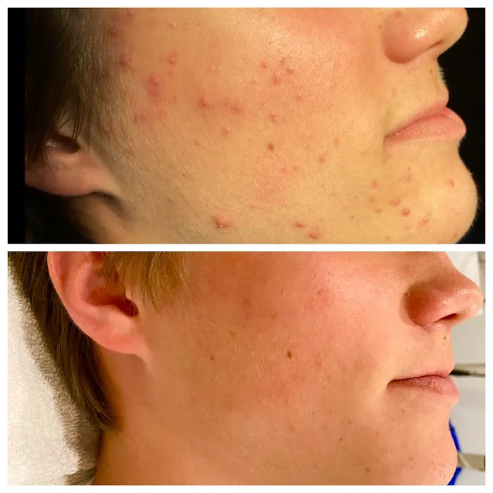 Vanessa Hernandez Skincare Picture 10