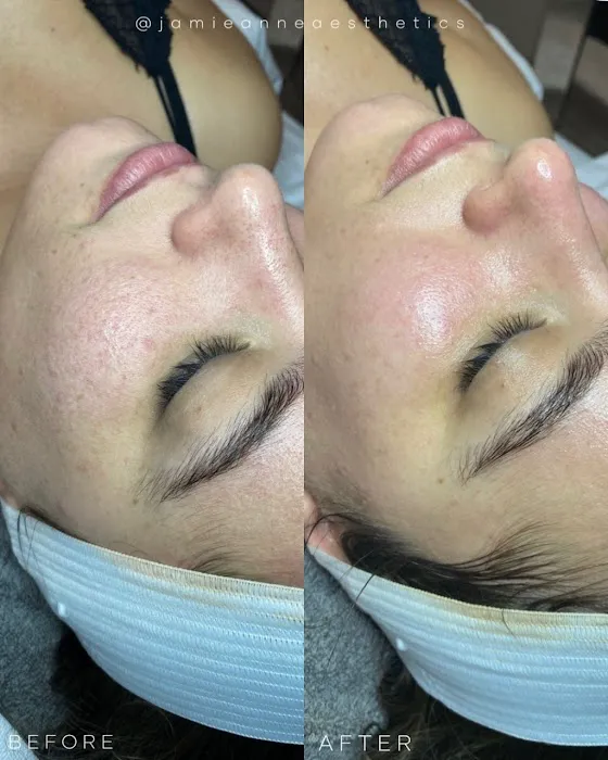 Jamie Anne Aesthetics Picture 6