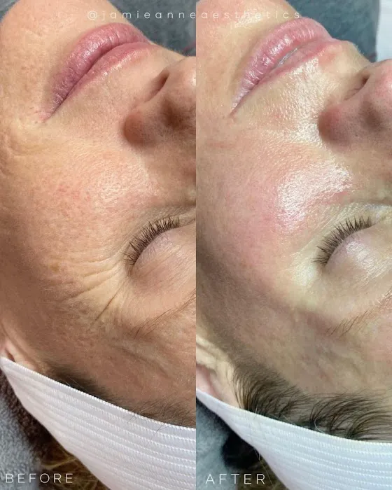 Jamie Anne Aesthetics Picture 3