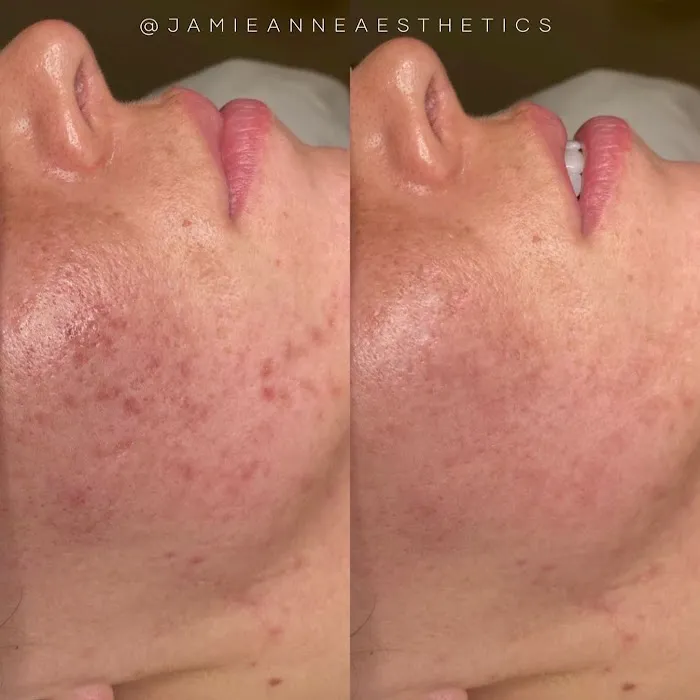 Jamie Anne Aesthetics Picture 8