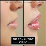 Consultant Clinic 90210
