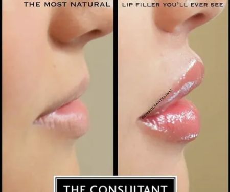 Consultant Clinic 90210