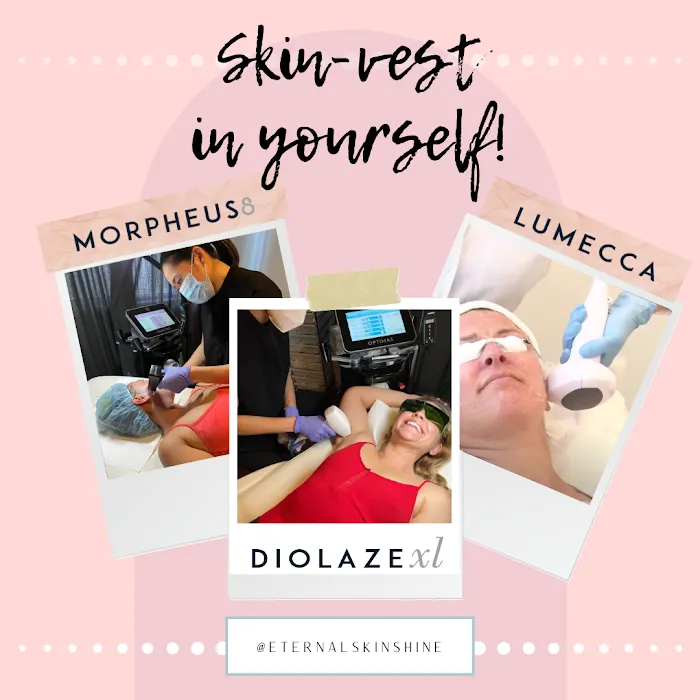 Eternal Skinshine Picture 10