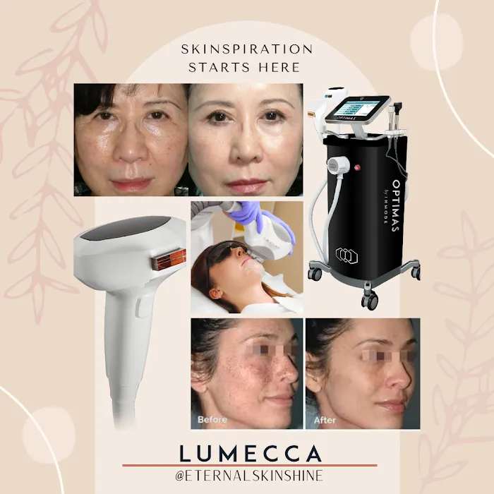 Eternal Skinshine Picture 9