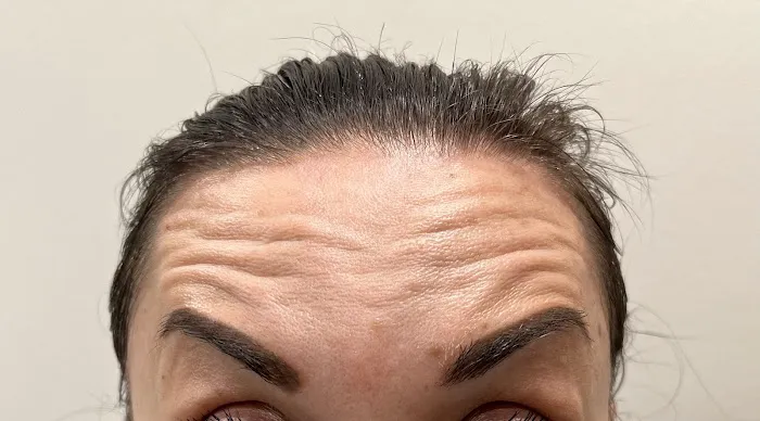 BH Aesthetic Medical Company Picture 5